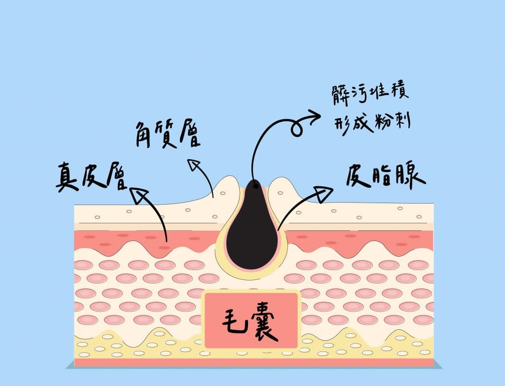 抗痘商品推薦排行榜TOP10【2025年最新版】